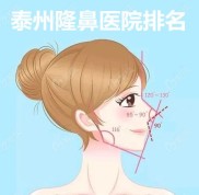泰州隆鼻醫(yī)院排名上是泰州做假體鼻綜合和鼻子修復(fù)好的醫(yī)院