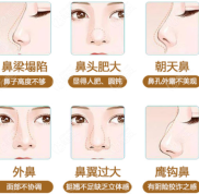 說到莆田隆鼻好的醫(yī)院都有誰呀