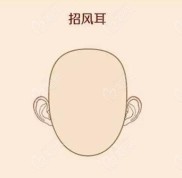 南寧做招風(fēng)耳矯正的醫(yī)院有愛(ài)思特和華美