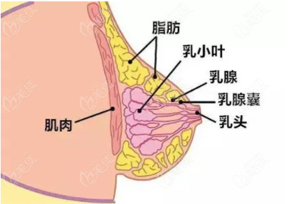 隆胸失败如何鉴定