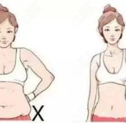了解成都趙敬國整形醫(yī)生做腰腹部吸脂的評(píng)價(jià)怎么樣前