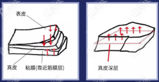 西安面部提升手术哪家医院做的好