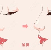 貴陽隆鼻好的醫(yī)生排名