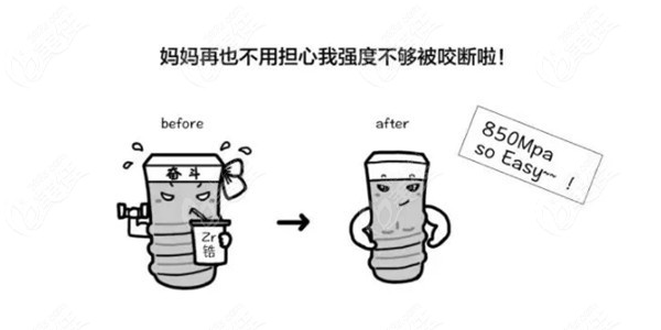 韩国登腾和DIO种植牙哪个好