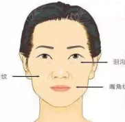 聽說杭州好漾做歐洲之星fotona4dpro面部提升不錯(cuò)不知