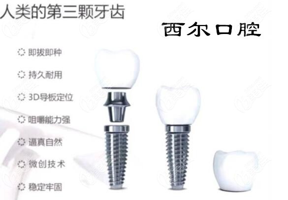 更新北京西尔口腔种植牙价格