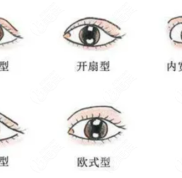 榆林割雙眼皮好的醫(yī)院是博愛哦