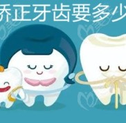 寶雞矯正牙齒大概多少錢