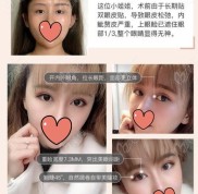 常州做一個(gè)眼綜合需要多少錢