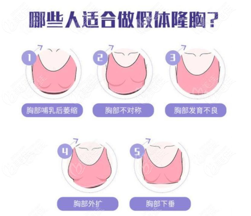 中国很难预约的十大隆胸专家排名
