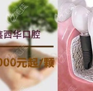 雅安鑫西華口腔醫(yī)院做韓系和德系種植牙的價(jià)格表已出