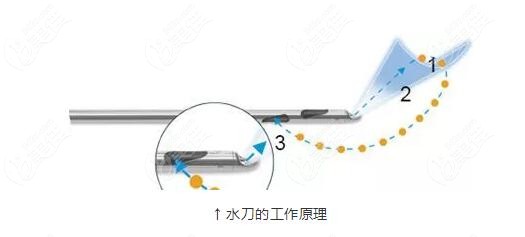 哈爾濱正規(guī)吸脂醫(yī)院排名榜前十