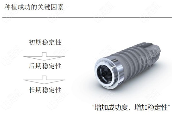 关于瑞士spi种植体和iti哪个好