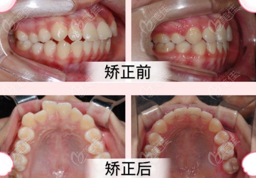 把唐山北極星和誠品口腔牙齒矯正哪個好對比了一番