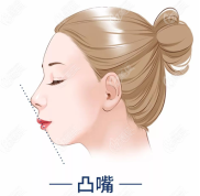 深圳凸嘴手術(shù)醫(yī)院推薦