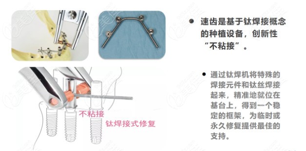 康康慈溪种植牙价格以及种牙较好的牙科和医生介绍吧