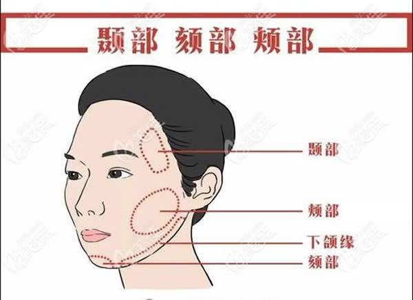 武汉能做拉皮手术的整形医院坐诊的都是做拉皮手术好的医生