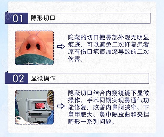 郑州鼻修复排名前十的医院医生