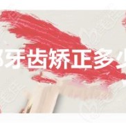 邯鄲牙齒矯正大概要花費多少錢