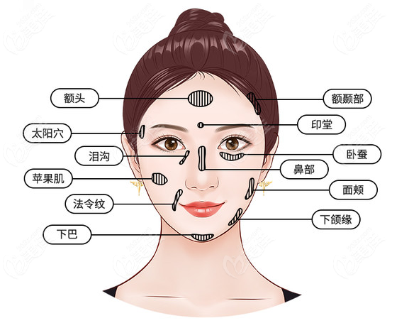 太原华美脂肪填充口碑好的医生是谁