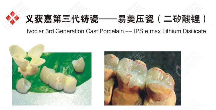 義獲嘉全瓷牙是哪個(gè)國(guó)家的品牌