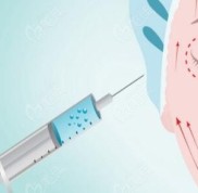 從沈陽杏林整形醫(yī)院官網(wǎng)了解到
