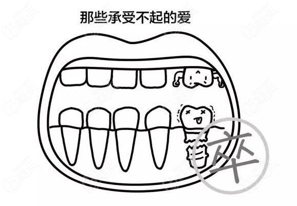 种植体用纯钛和钛锆合金哪个好