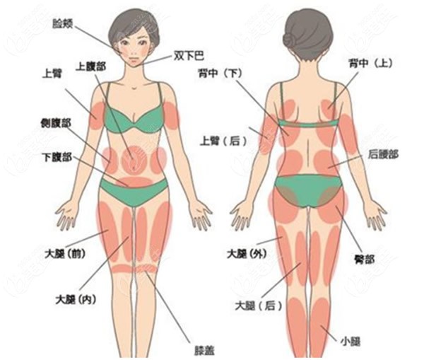 全身吸脂是不可以一次性完成的