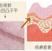 這份泉州祛疤醫(yī)院排行榜