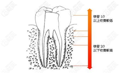 看完深圳牙科根管治療價(jià)格后