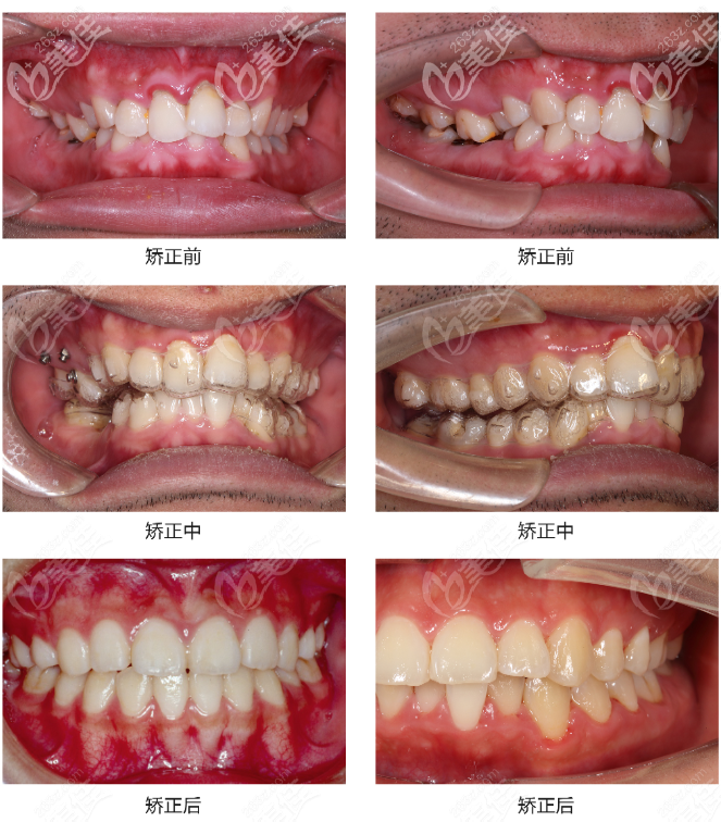 剛拿到廣州好大夫口腔收費(fèi)標(biāo)準(zhǔn)