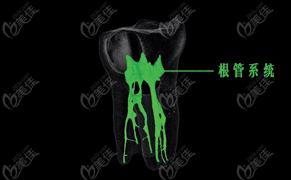 显微根管治疗费用多少