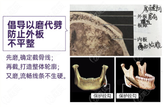 在贵阳做下颌角截骨好的医院里做削骨整形需要多少钱呢