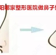 沈陽哪家整形醫(yī)院做鼻子好
