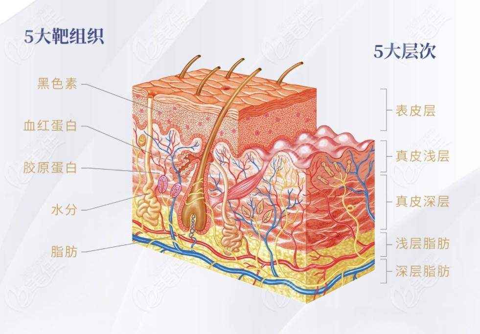 5D膠原光和半島超聲泡的區(qū)別在于作用層次和緊致原理完全不同