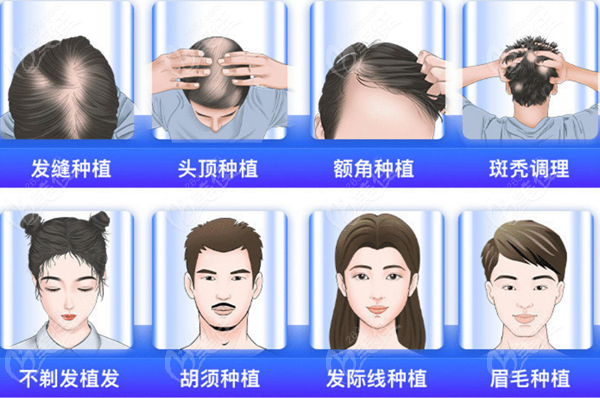 杭州植发专科医院排行榜前十名单及价格分享
