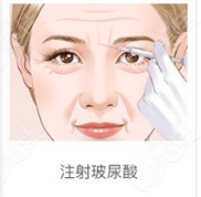 鄭州注射玻尿酸好的醫(yī)生知道哪個(gè)整形醫(yī)院打玻尿酸好還正規(guī)