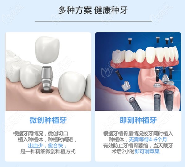 上海華美整形醫(yī)院價(jià)格表太颯了