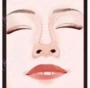沈陽(yáng)做隆鼻失敗修復(fù)好的醫(yī)生名單來(lái)了
