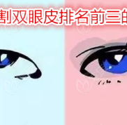 無錫割雙眼皮排名前三的醫(yī)院