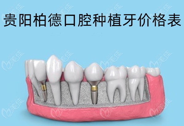 分享贵阳柏德口腔种植牙价格表及种植牙技术怎么样