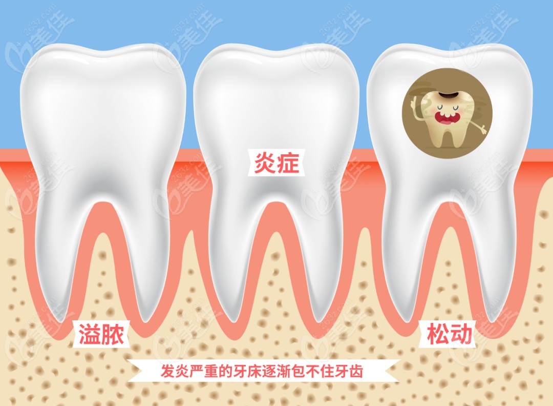 牙周炎萎縮的牙齦能恢復么