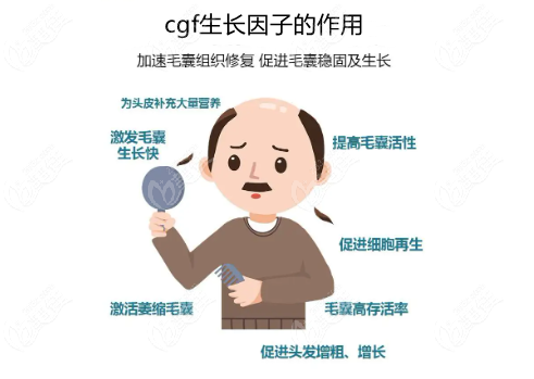 来看上海能做cgf治疗脱发的医院名单