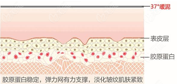 熱瑪吉做完多久后可以做光子嫩膚呀