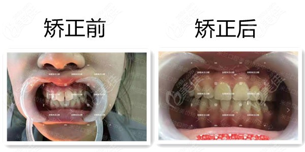 沈阳米兰口腔正畸好的医生搁这儿