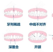 新鄉(xiāng)口腔醫(yī)院矯正牙齒多少錢