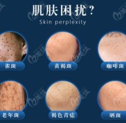 山西太原做激光祛斑手術(shù)好的正規(guī)醫(yī)院排行榜來(lái)看公辦醫(yī)院有哪家