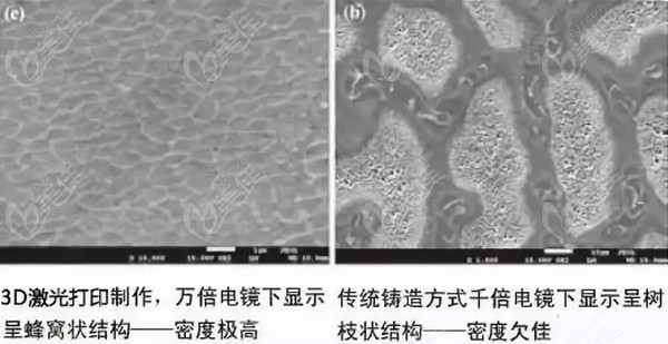 從3d打印全口義齒的價格及優(yōu)缺點