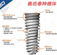 小編帶你看桂林口腔醫(yī)院做種植牙的價格吧
