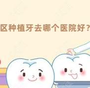 南京建鄴區(qū)種植牙去哪個(gè)醫(yī)院好